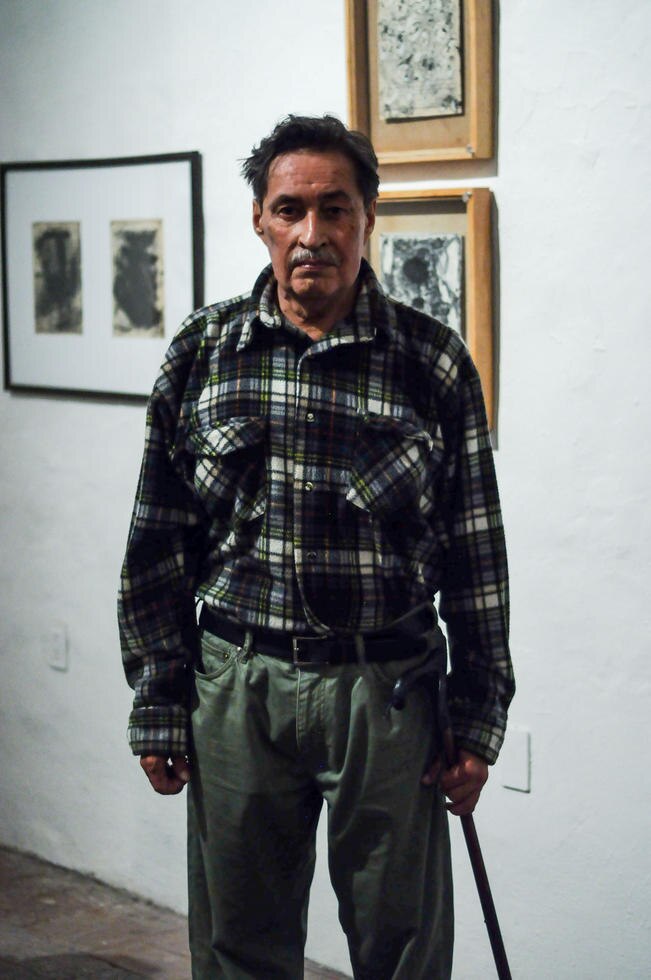 Urge riñón para el artista Gerardo Esquivel