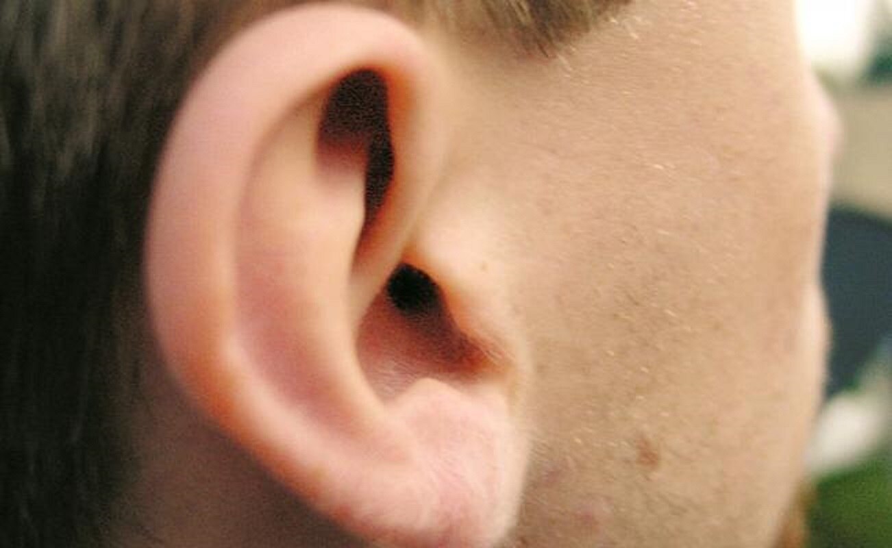 Uso de cotonetes puede causar infecciones en los oídos