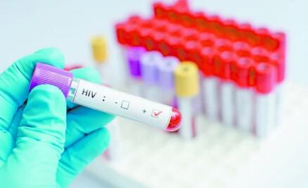 Es el segundo caso. Paciente con VIH se cura con trasplante de células madre