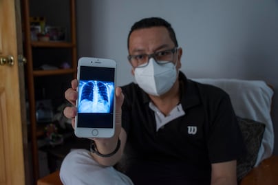 “Duermo muy poco por miedo a que algo más vaya a pasar”: La vida después del Covid-19