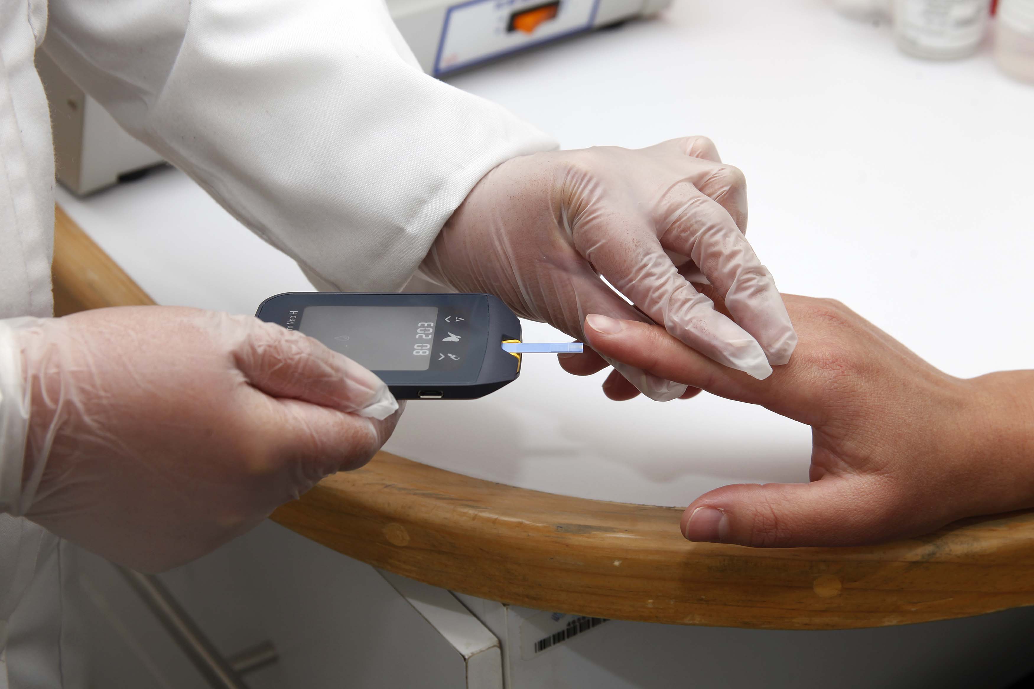 Insuficiencia renal se eleva 30% en SJR