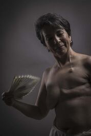 Mastectomía. La cicatriz es la medalla de triunfo