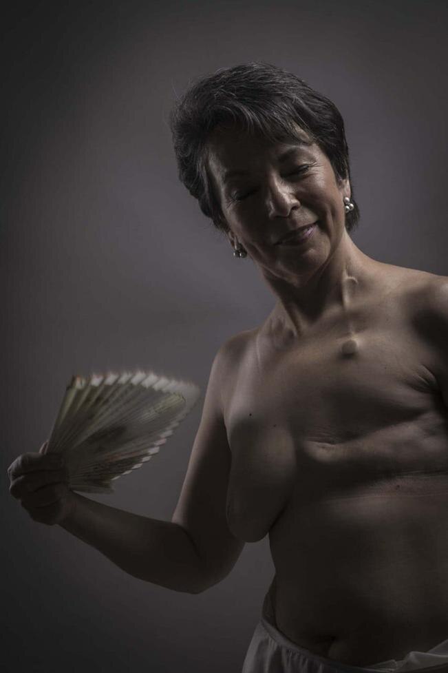 Mastectomía. La cicatriz es la medalla de triunfo