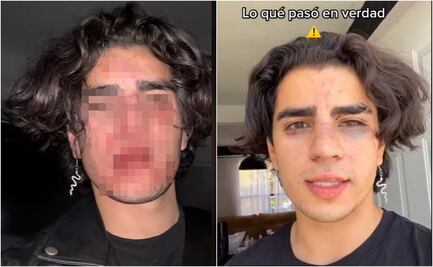 VIDEO. Influencer denuncia en TikTok agresión de personal de un bar en Querétaro