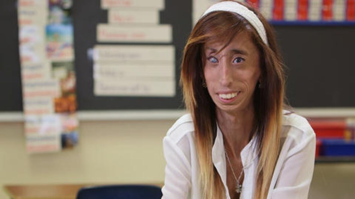 El ángel que cuida a Lizzie Velásquez 