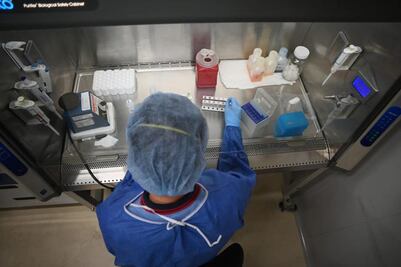 Querétaro no ha contabilizado 700 casos de Covid-19