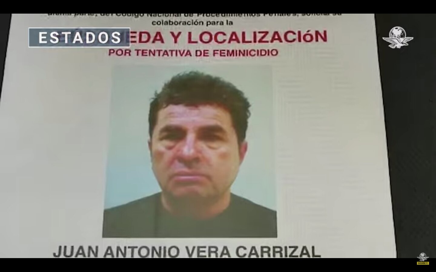 Ofrecen hasta un millón de pesos para dar con exdiputado por ataque con ácido a saxofonista