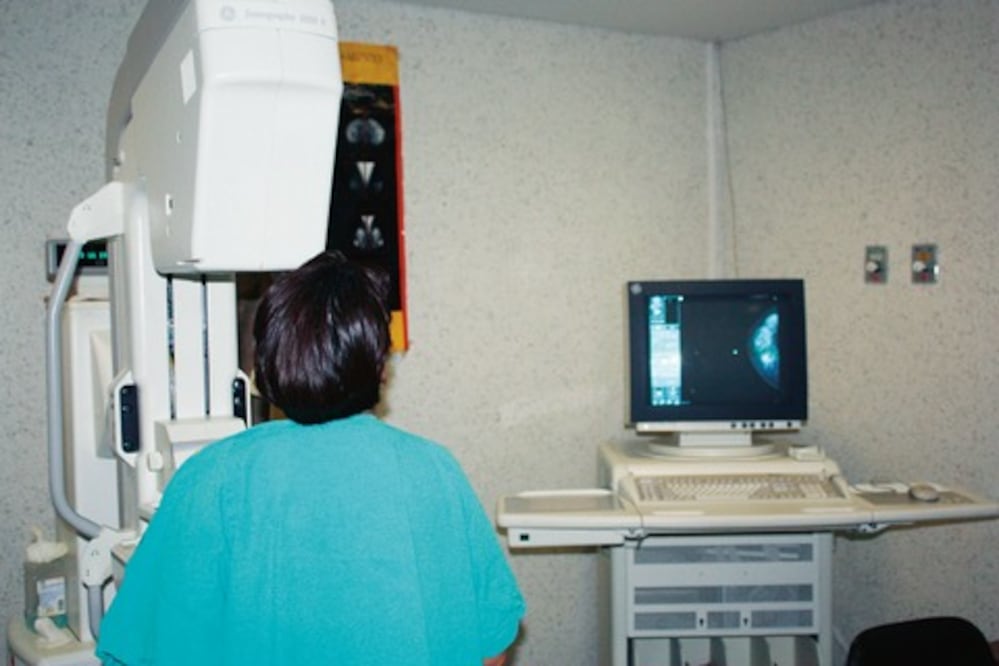 Mortalidad por cáncer de mama, a la baja