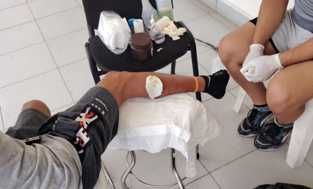 Migrante cubano enfermo por gusano barrenador pide ayuda a Sheinbaum; busca permiso para llegar a CDMX