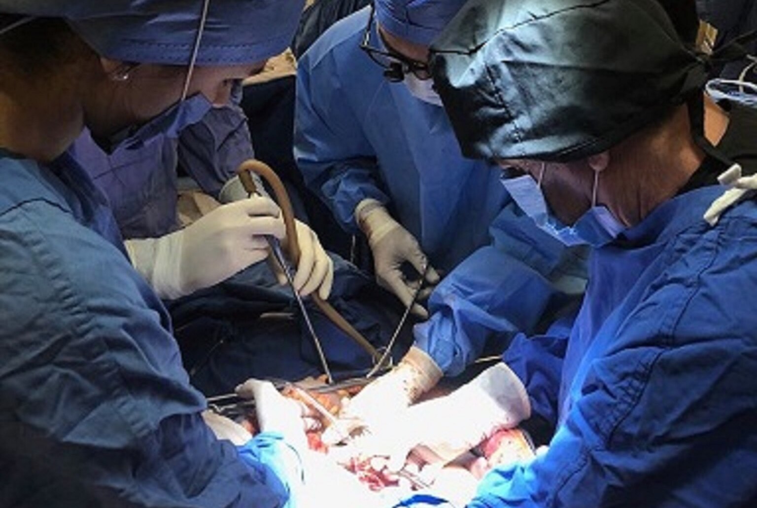 La Secretaría de Salud, a través del Hospital General de Querétaro, logra donación multiorgánica