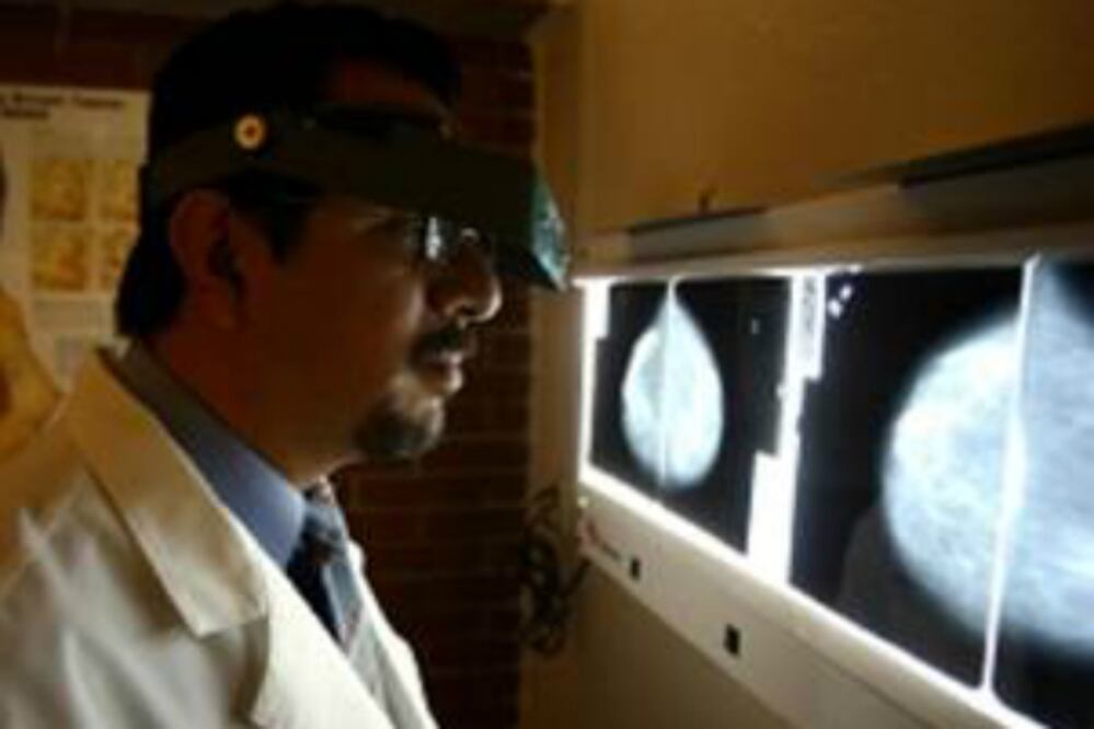 Detectan 56 casos de cáncer de mama en SJR