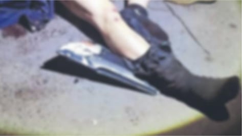 Encuentran muerto a presunto delincuente en Edomex, a otro le abrieron la cabeza