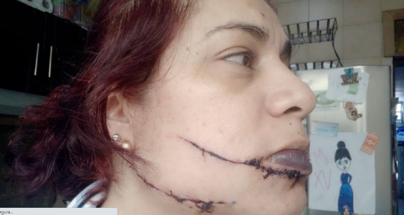 A Jennifer le cortaron la cara, sospecha de su ex