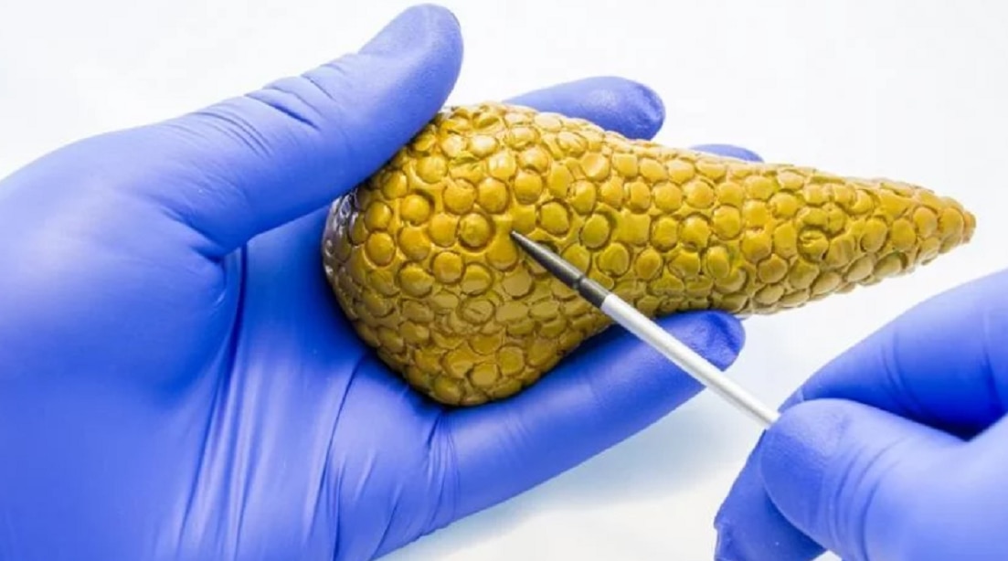 Crean páncreas bioartificial que podría ser la “cura” para la diabetes