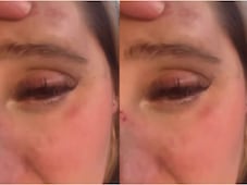 Isa Castro publica video con el rostro golpeado; acusa a su pareja, quien ya la habría agredido anteriormente