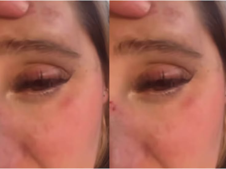 Isa Castro publica video con el rostro golpeado; acusa a su pareja, quien ya la habría agredido anteriormente