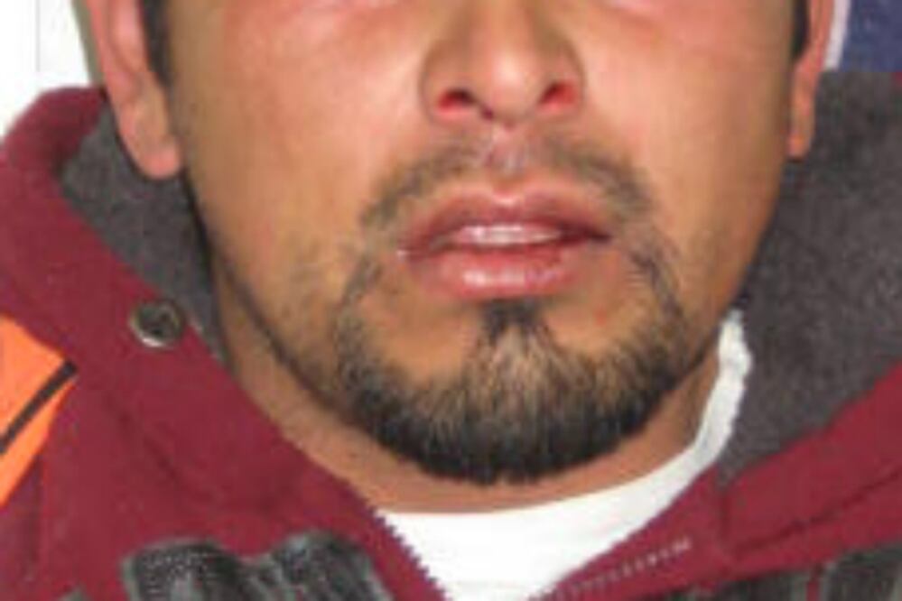 Muerde sujeto a policía en SJR