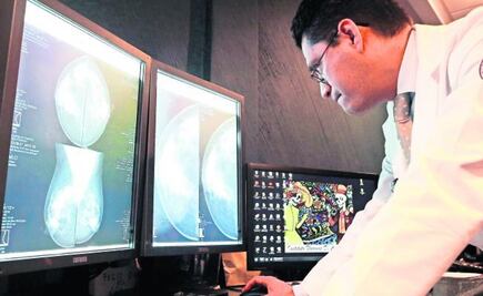 Hormonoterapia ayuda a preservar senos de mujeres con cáncer de mama