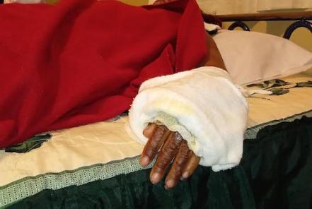 Olivia, mujer quemada con aceite y ácido, quiere que su agresor vea las consecuencias