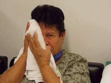 Casos de parálisis facial