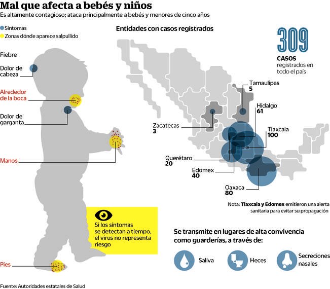 Alerta de virus de coxsackie, en siete entidades del país