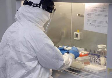 Van 23 casos de viruela símica en Querétaro