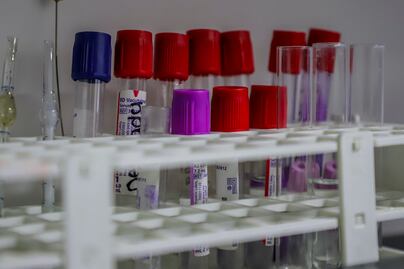 UAQ, sin recursos para desarrollar la vacuna anticovid