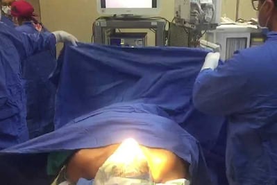 Novedosa cirugía: operan tiroides sin cicatriz