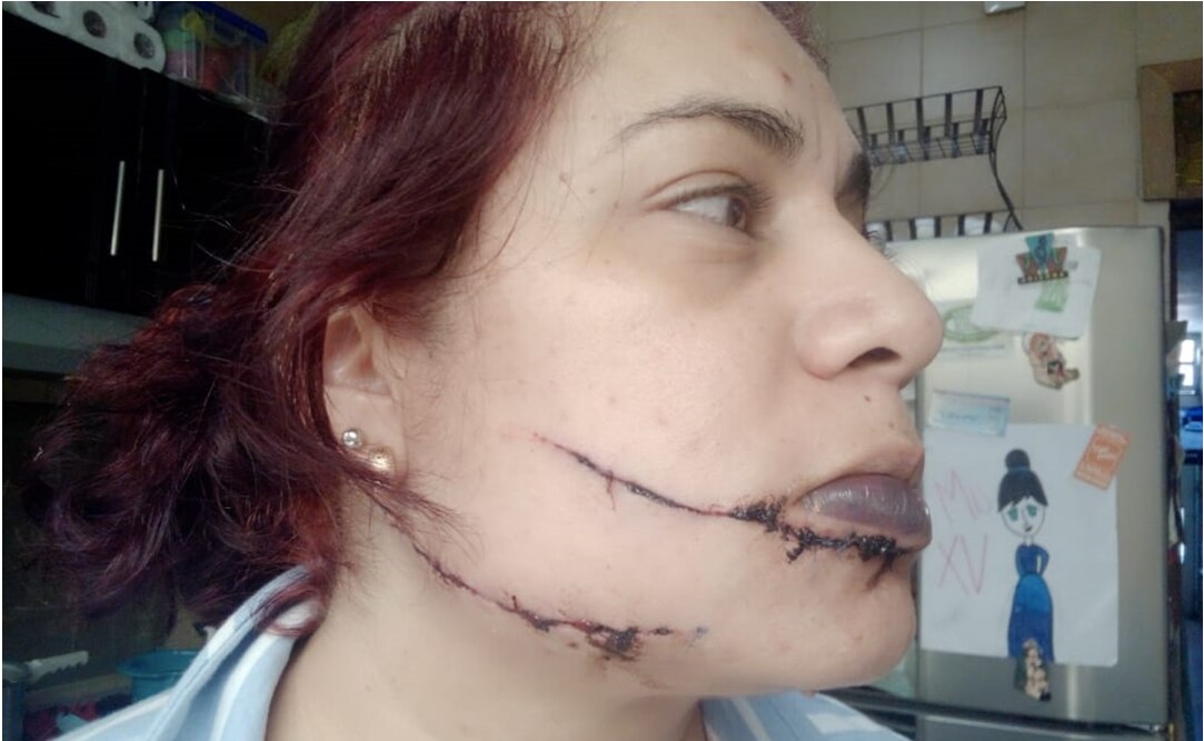 "Sabes de parte de quién es"; a Jennifer le cortaron la cara, sospecha de su ex