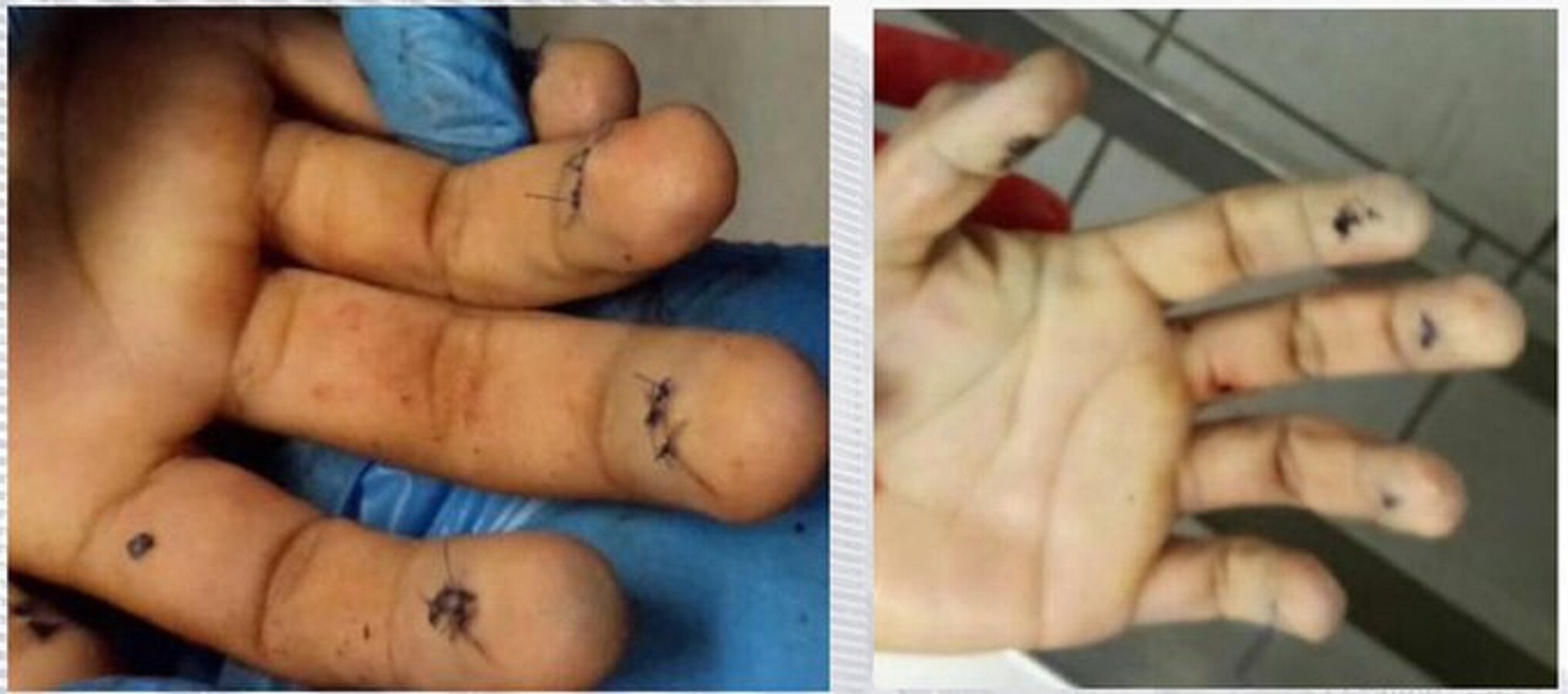 Presunto ladrón de energético intentó quitarse huellas dactilares