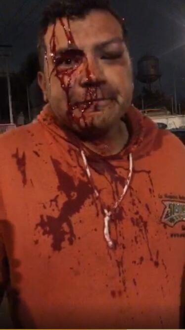 Foto: Periodista agredido. (Tomada del video: Cortesía Isidro Corro)