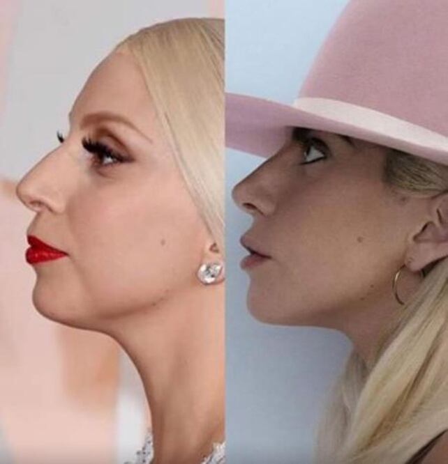 Acusan a Gaga de traicionar ideales con su cirugía estética