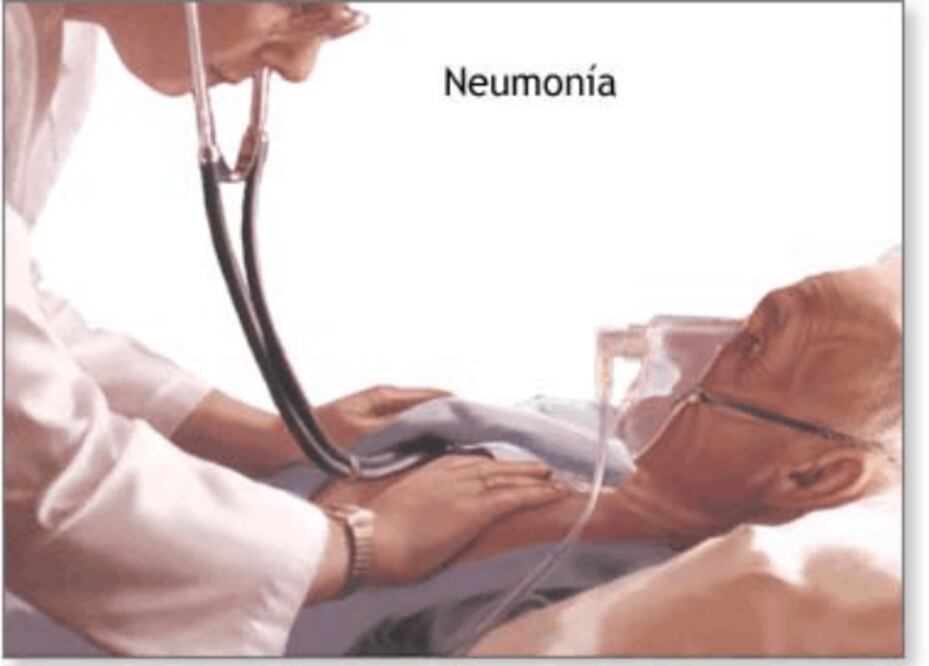 Disminuyen muertes por neumonía