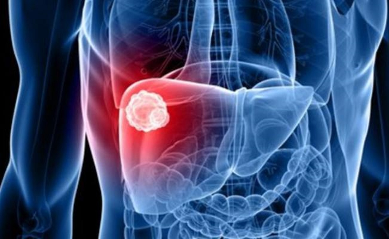 Científicos crean por primera vez un modelo de tumor de hígado humano