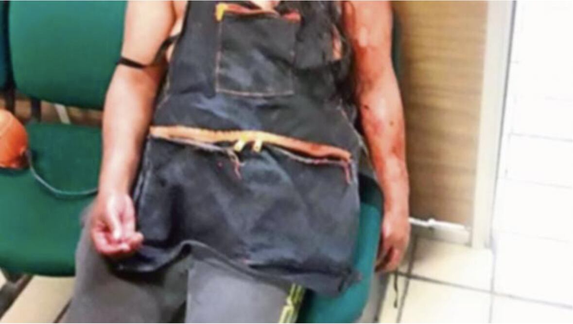 Mujer pelea con su esposo y le corta la cabeza en Edomex, se le cayó a media calle