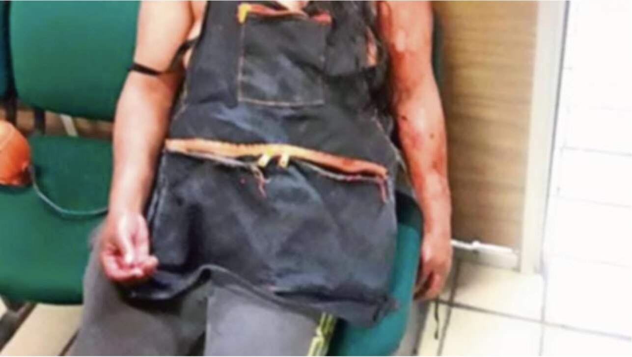 Mujer pelea con su esposo y le corta la cabeza en Edomex, se le cayó a media calle