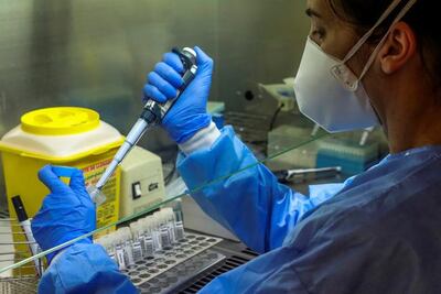 Laboratorios se unen contra el coronavirus