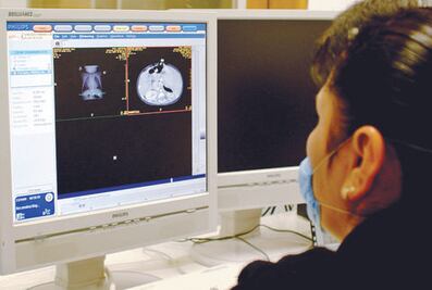 “Importante, combatir cáncer cervicouterino”