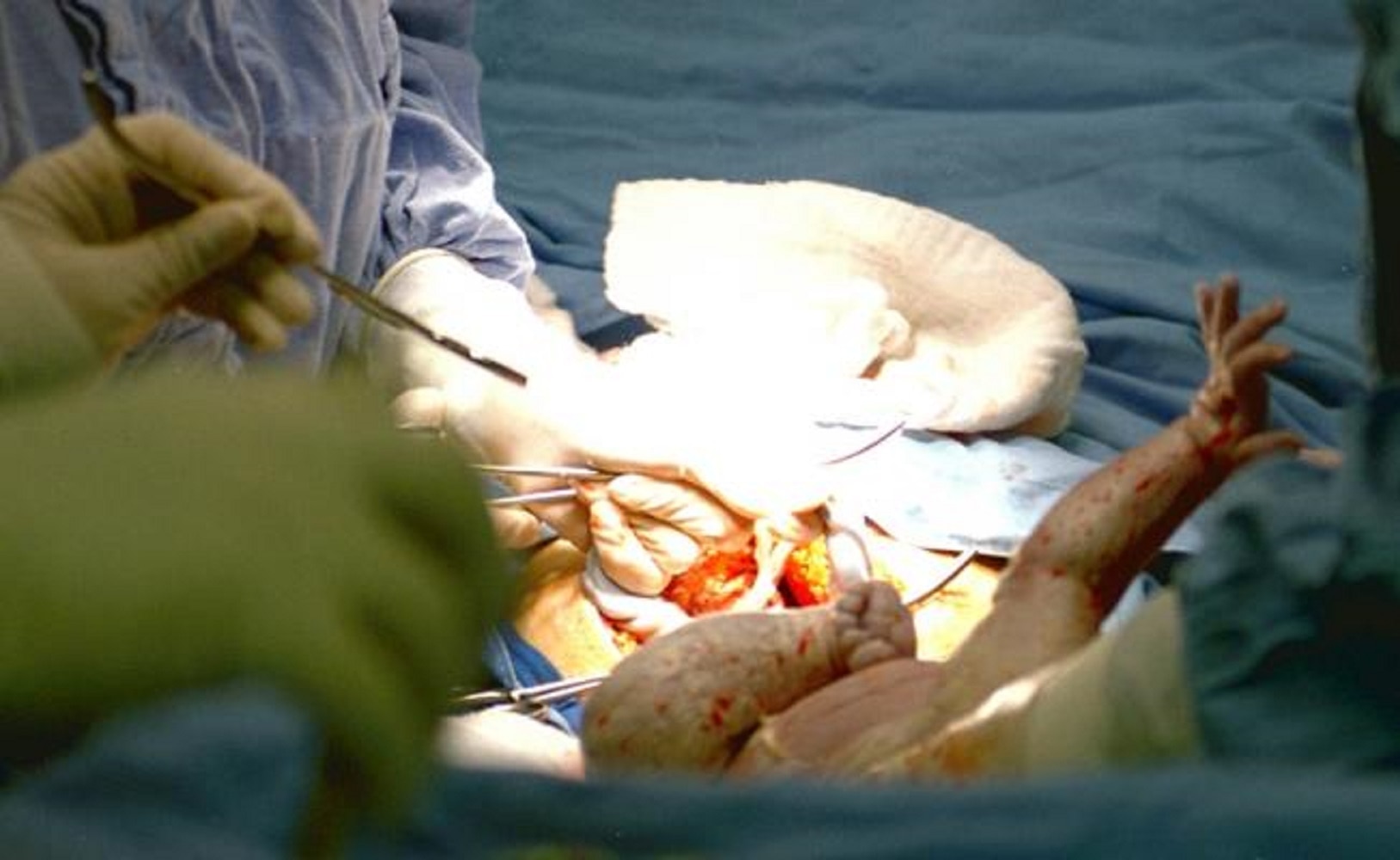 Bebé nace en China cuatro años después de la muerte de sus padres