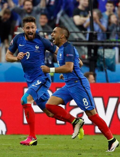 Sonrisa a la francesa ante sicosis