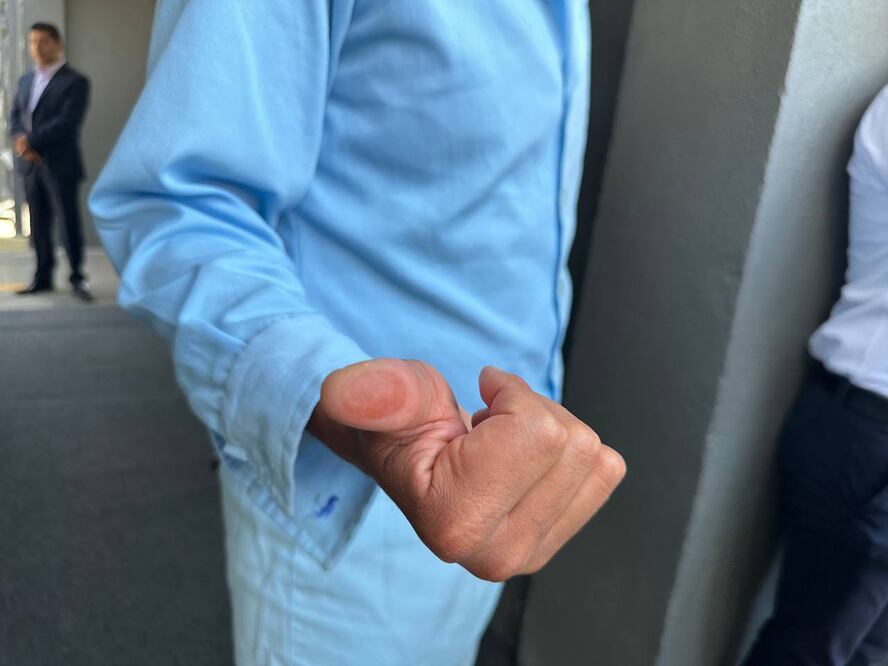 FOTO: MIYAZAQUI BLANCO