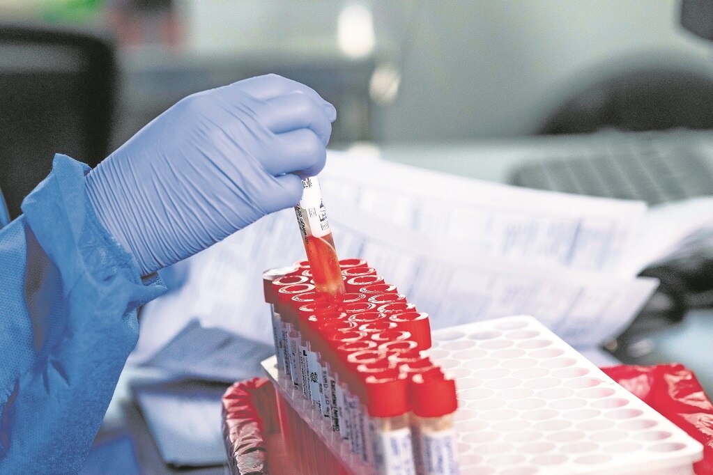 Confirman 13 contagios de viruela símica en Querétaro