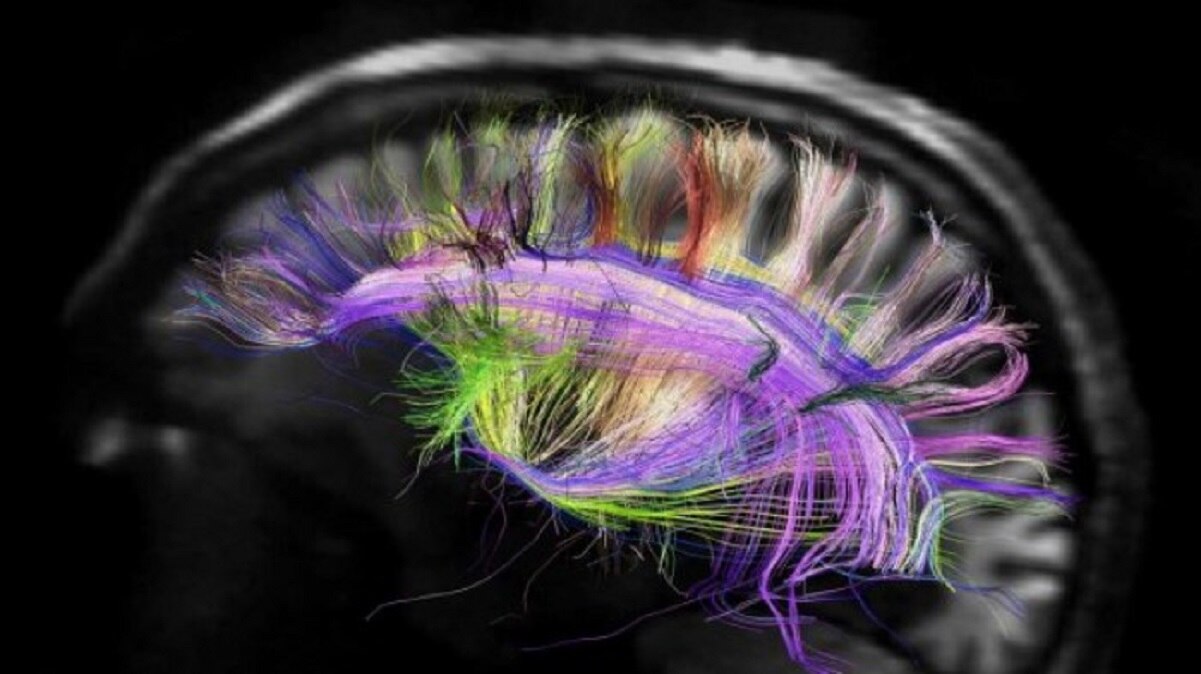 La Semana del Cerebro, el evento de la UNAM Juriquilla para promover el conocimiento de este órgano