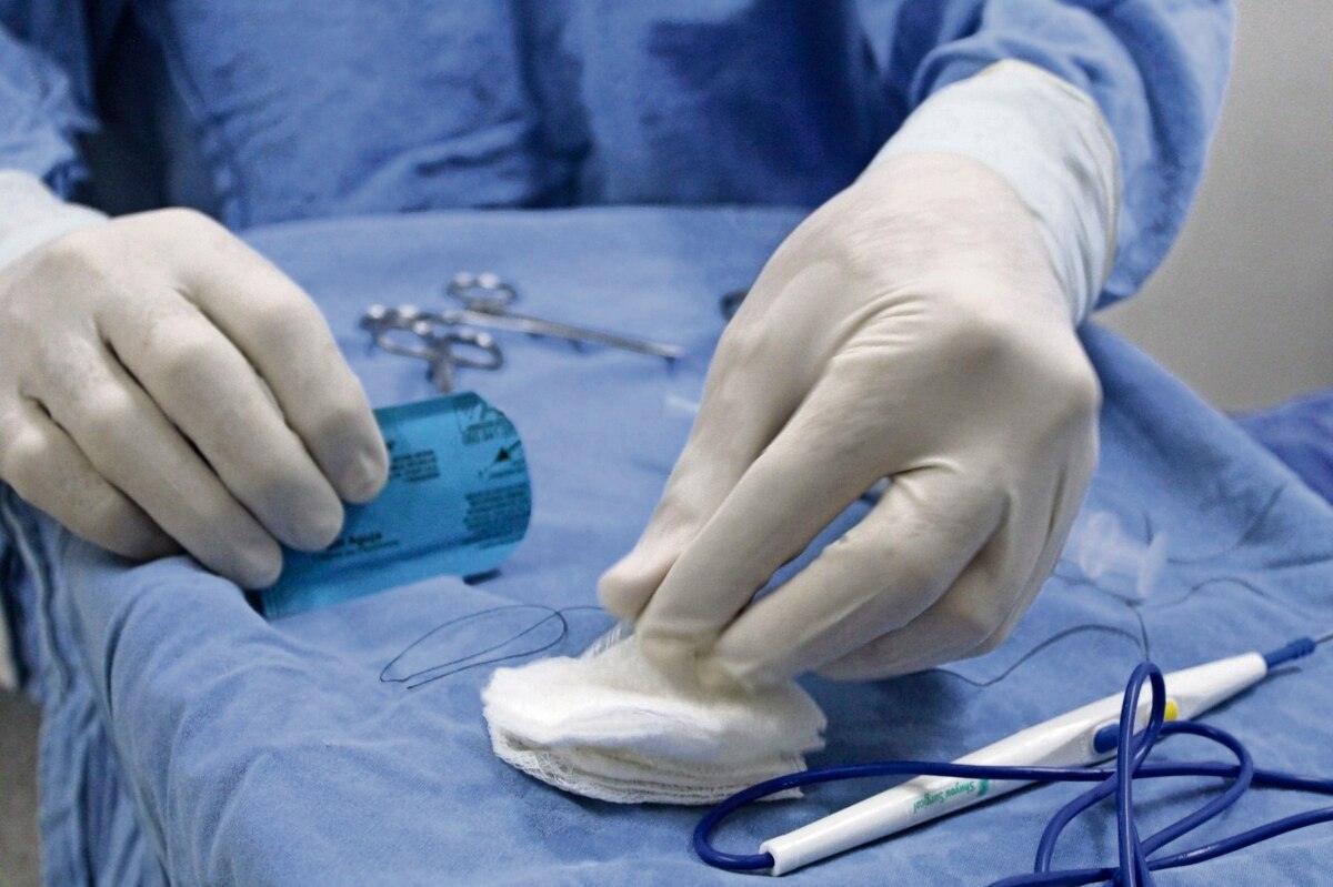 IMSS realiza 128 vasectomías sin bisturí en Querétaro