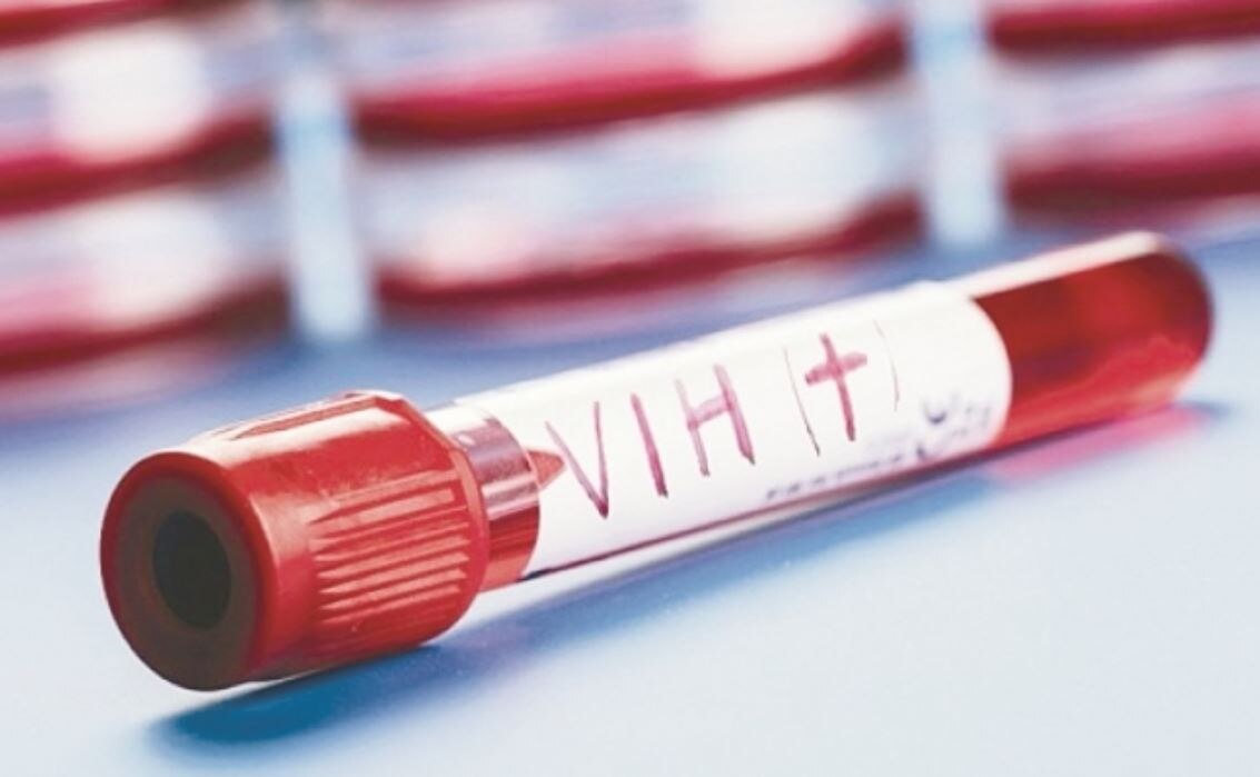 UNAM obtiene patente para proteger hígado en pacientes con VIH