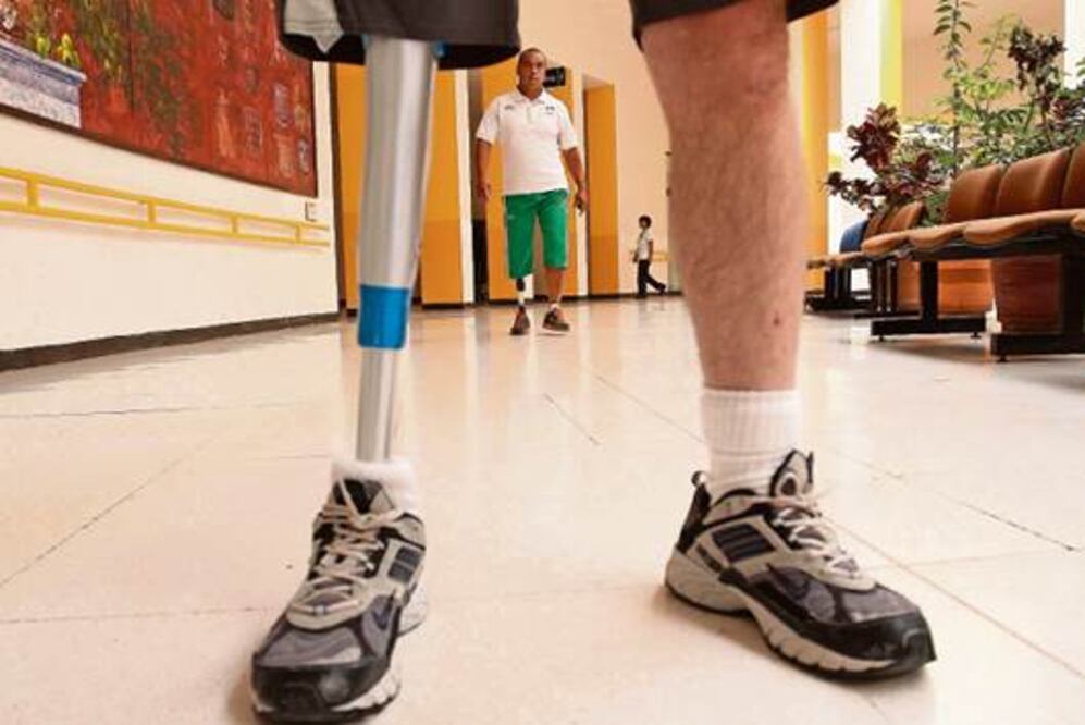 Querétaro, pionero en prótesis tecnológica