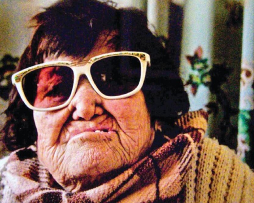 Fortalecen acciones para evitar la Lepra