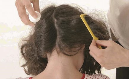 Alertan por posibles contagios de piojos en escuelas