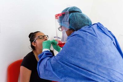 Prueba de la UAQ muestra efectividad