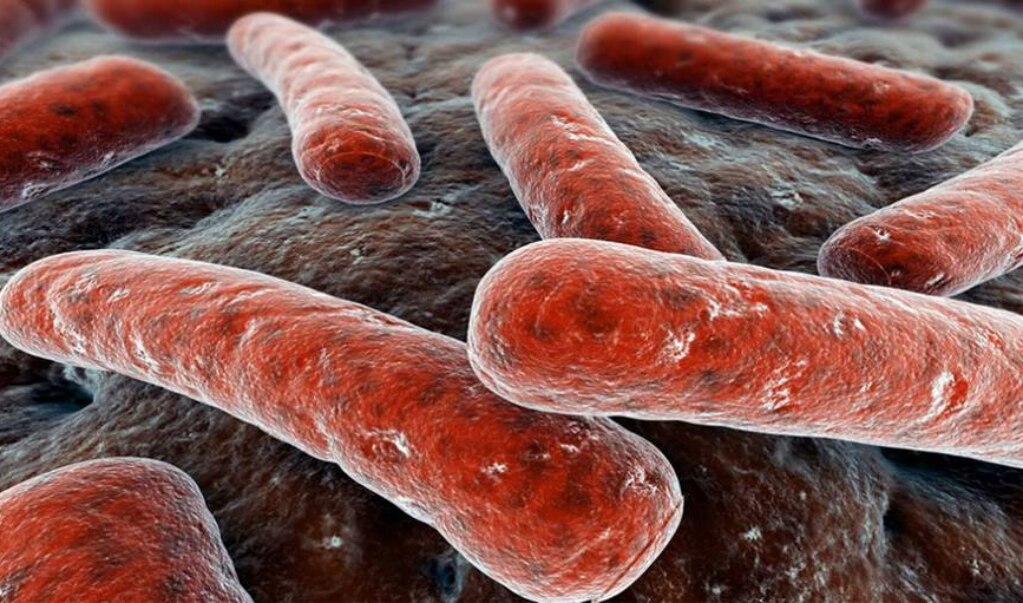 Tuberculosis es mayor causa de muertes entre seropositivos, según ONUSIDA